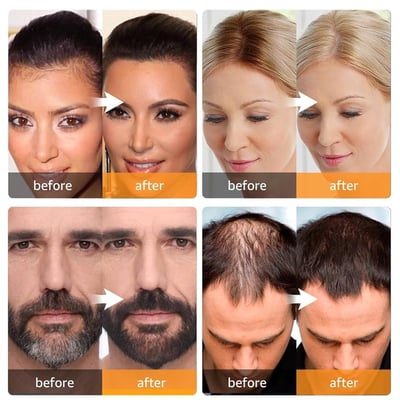 🔥2025 Year Hot Sale 50% OFF 🔥Poudre pour ligne de cheveux