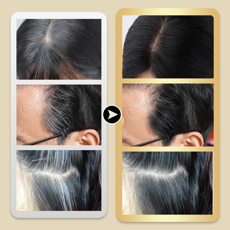 ⏳Réduction limitée de 50%🎁Purement naturel et non irritant ✅ Teinture capillaire végétale exclusivement fournie en Europe