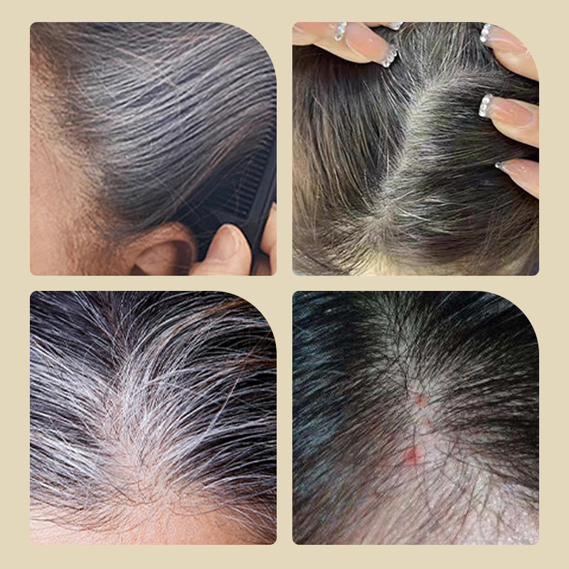 ⏳Réduction limitée de 50%🎁Purement naturel et non irritant ✅ Teinture capillaire végétale exclusivement fournie en Europe