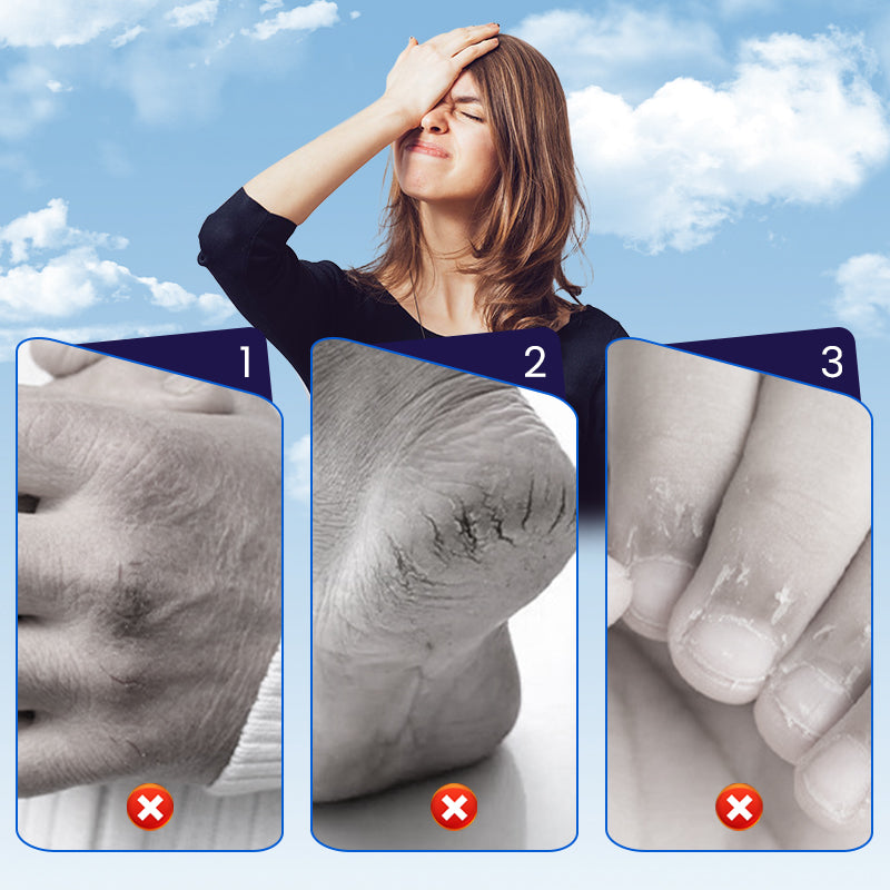 ⏳Spécial à durée limitée⏰Patch réparateur pour la peau craquelée des mains et des pieds🩹