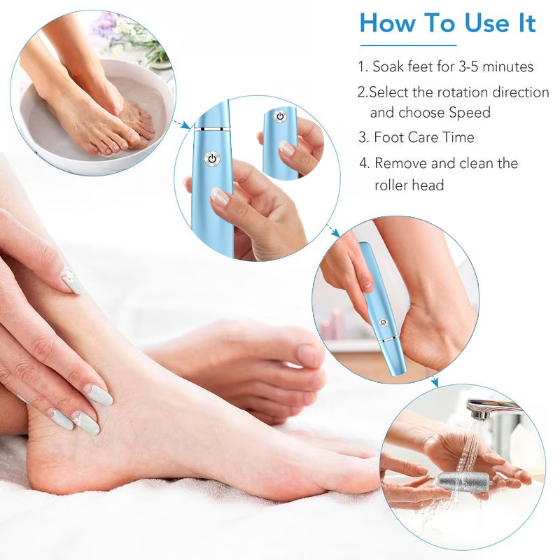 Extracteur de callosités électrique pour les pieds