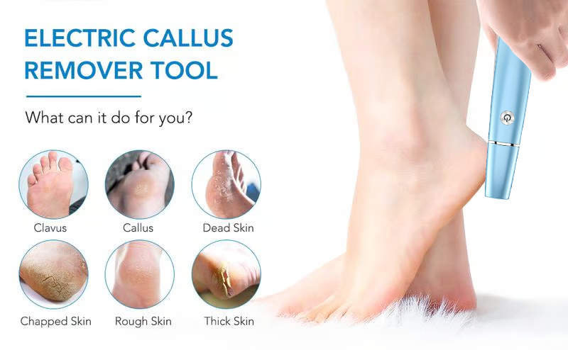 Extracteur de callosités électrique pour les pieds