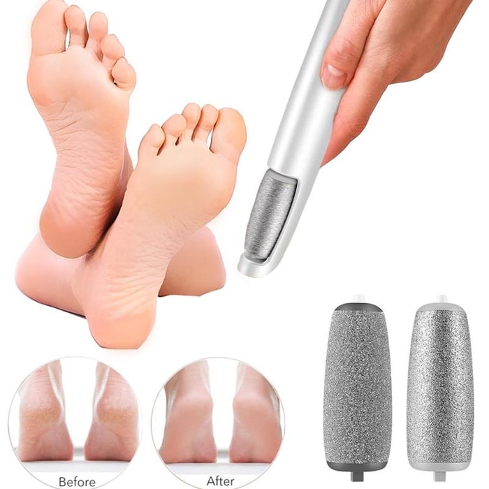 Extracteur de callosités électrique pour les pieds