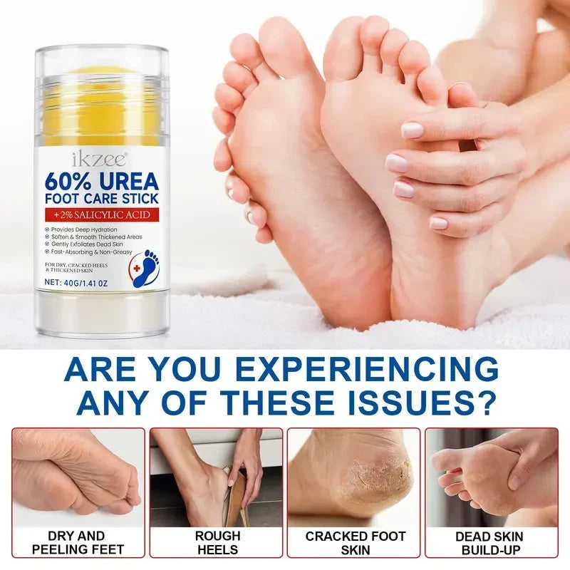 🎉Plus de 42 000 vendus 🦶 Baume hydratant intensif à l'urée pour les pieds, idéal pour les talons secs et crevassés et les peaux mortes.