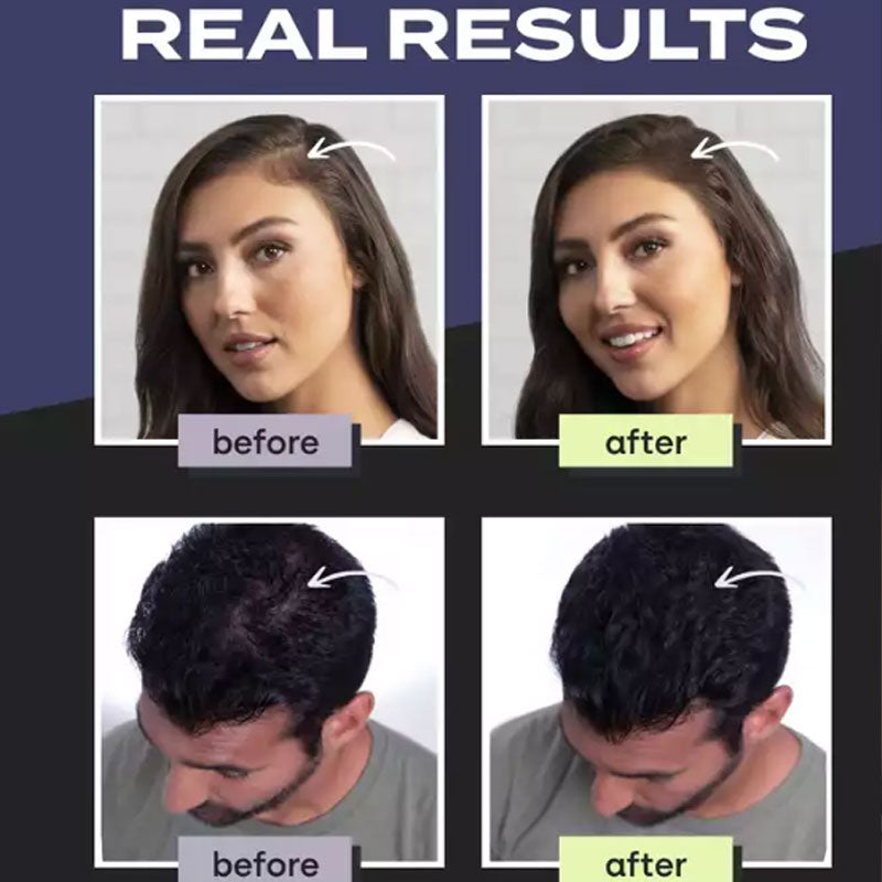 🔥‑50% PROMO FLASH💇‍♀️ Ensemble fibres capillaires pour cheveux clairsemés, masque les zones de calvitie instantanément ✨