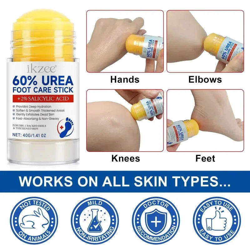 🎉Plus de 42 000 vendus 🦶 Baume hydratant intensif à l'urée pour les pieds, idéal pour les talons secs et crevassés et les peaux mortes.